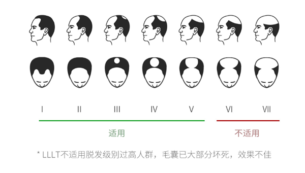 Xiaomi ra mắt mũ kích thích mọc tóc cho người bị hói, giá 4.9 triệu đồng - Ảnh 4.