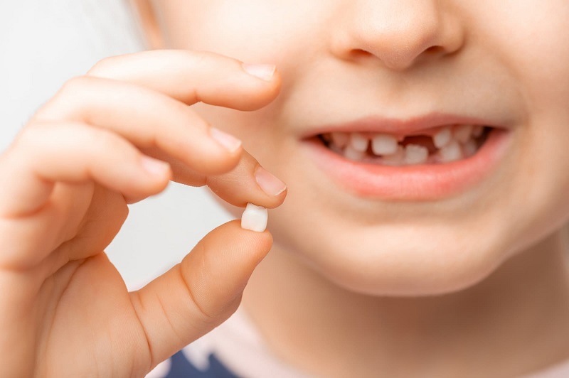 Dựa vào mức độ sẽ có cách xử lý khi răng sữa của trẻ bị mòn phù hợp. Dưới đây là một số gợi ý.